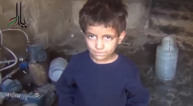 طفل سوري يعاني من الجوع